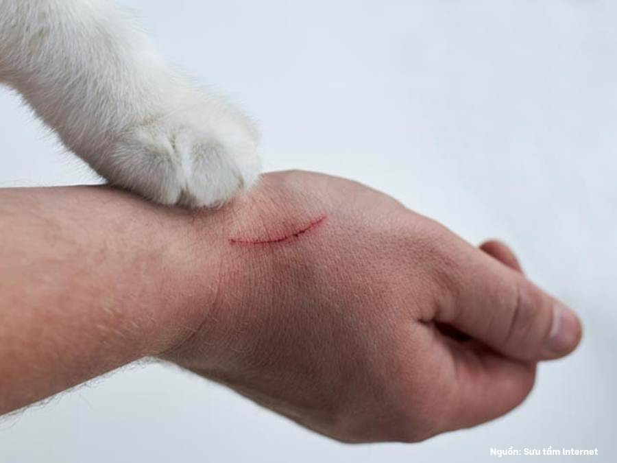 Ngủ mơ bị mèo cắn chảy máu